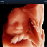 1 2 EC 8 OB LiveHQ