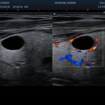 Copia de 1 3 Thyroid Dual